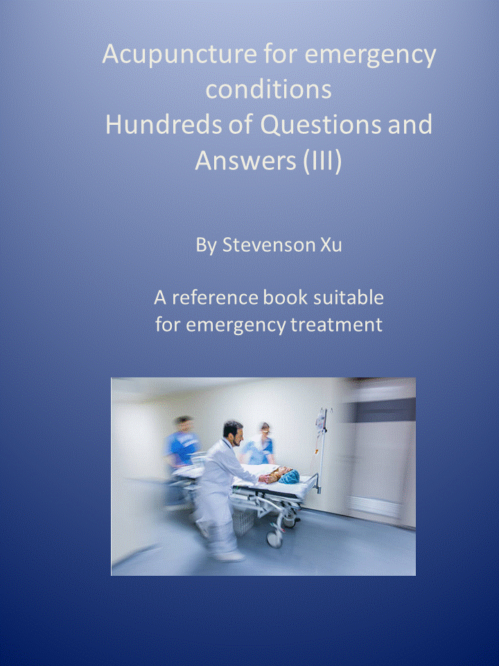 Acupuncture, hundreds of questions and answers